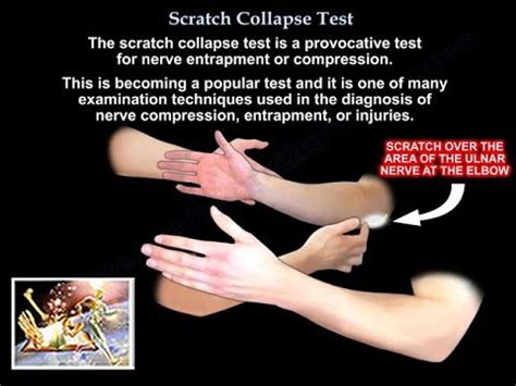 scratch collapse test|long thoracic nerve injury test.